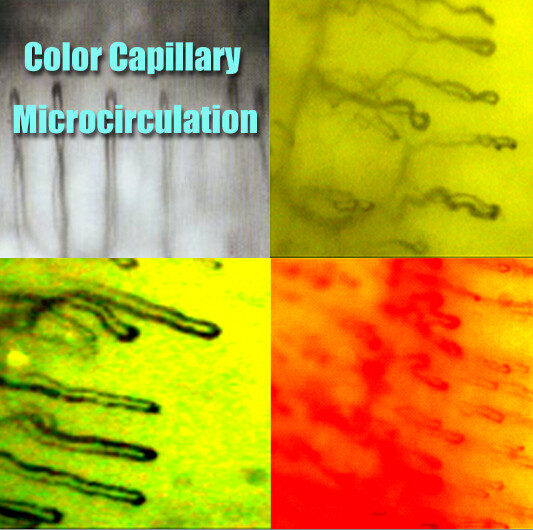China Hospital Nailfold Capillary Microscopy /  Microcirculation Microscope Multi Function for Medical on sale