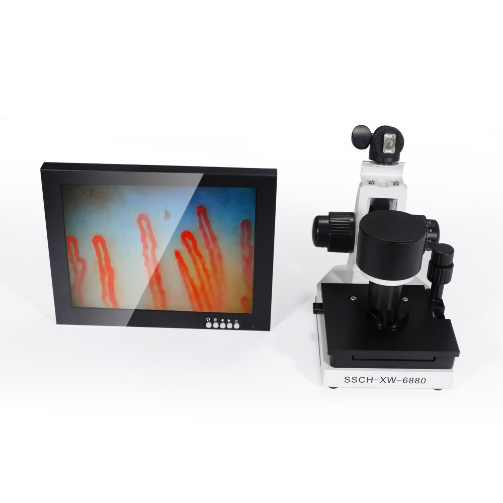 China Portable 10 Inch LED Display Nail Fold Capillaroscopy Microcirculation Test Machine on sale