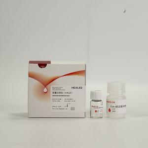 China HEALES Urine MALB Test 50 Tests / Kit In Vitro Diagnostic on sale