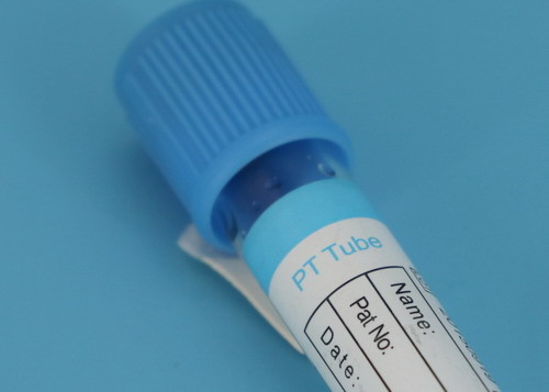 Quality Medical Disposable Centrifuge Tube / Blood Collection Tube CE ISO Approved wholesale