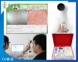 China Facial Skin Moisture Analyzer Machine Skin Scope Analyzer Multi Function and Security on sale