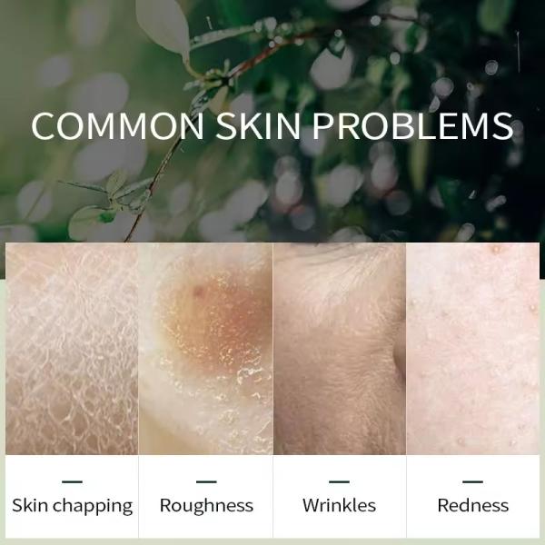 Avocado Hydrating Face Cream Hyaluronic Acid OEM Skin Care Manufacturer