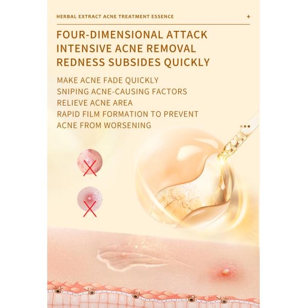 Skincare Essence Face Serum Moisturizer Cream For Anti Acne Facial Whitening 50g