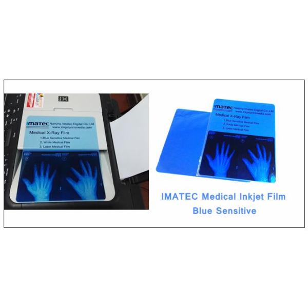 Digital Blue Based Inkjet Printing Medical Radiology X - Ray Film 280gsm