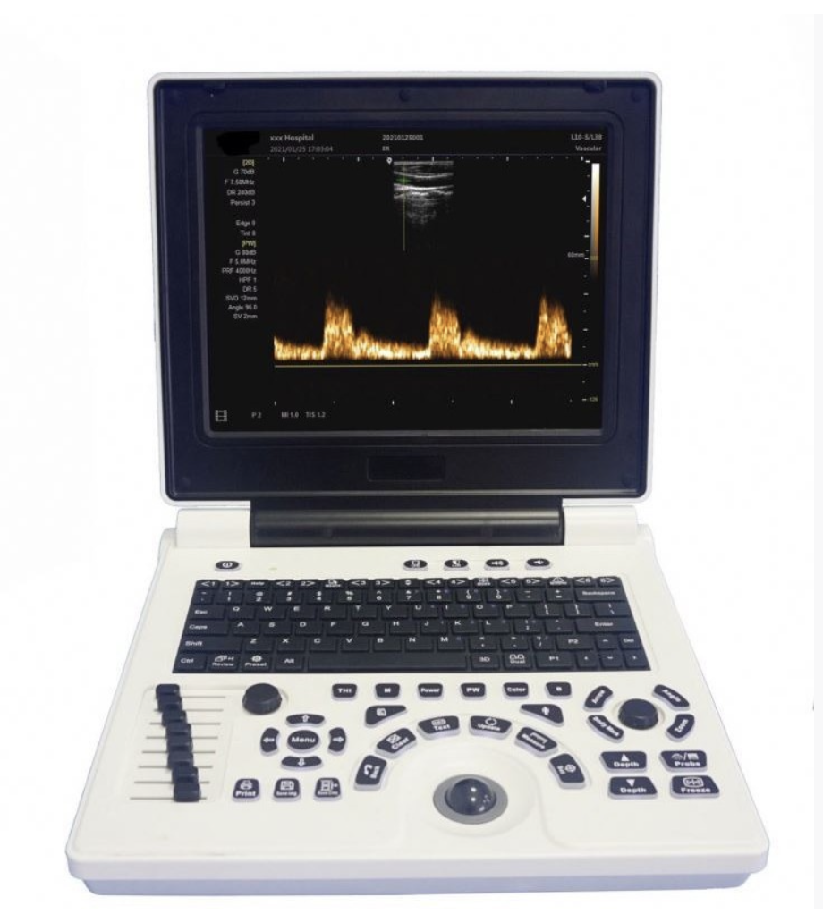 Hospital Newborn Infant Incubator Warmer Equipment 630x360 Mm Tray