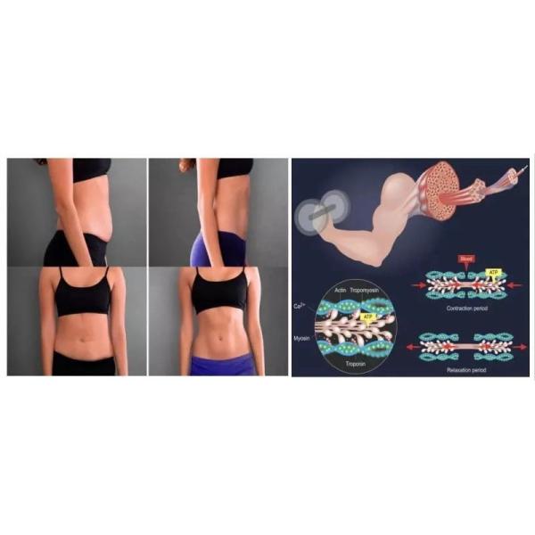 ABS EMS Body Sculpting Machine Commercial Electric EMS Muscle Stimulator