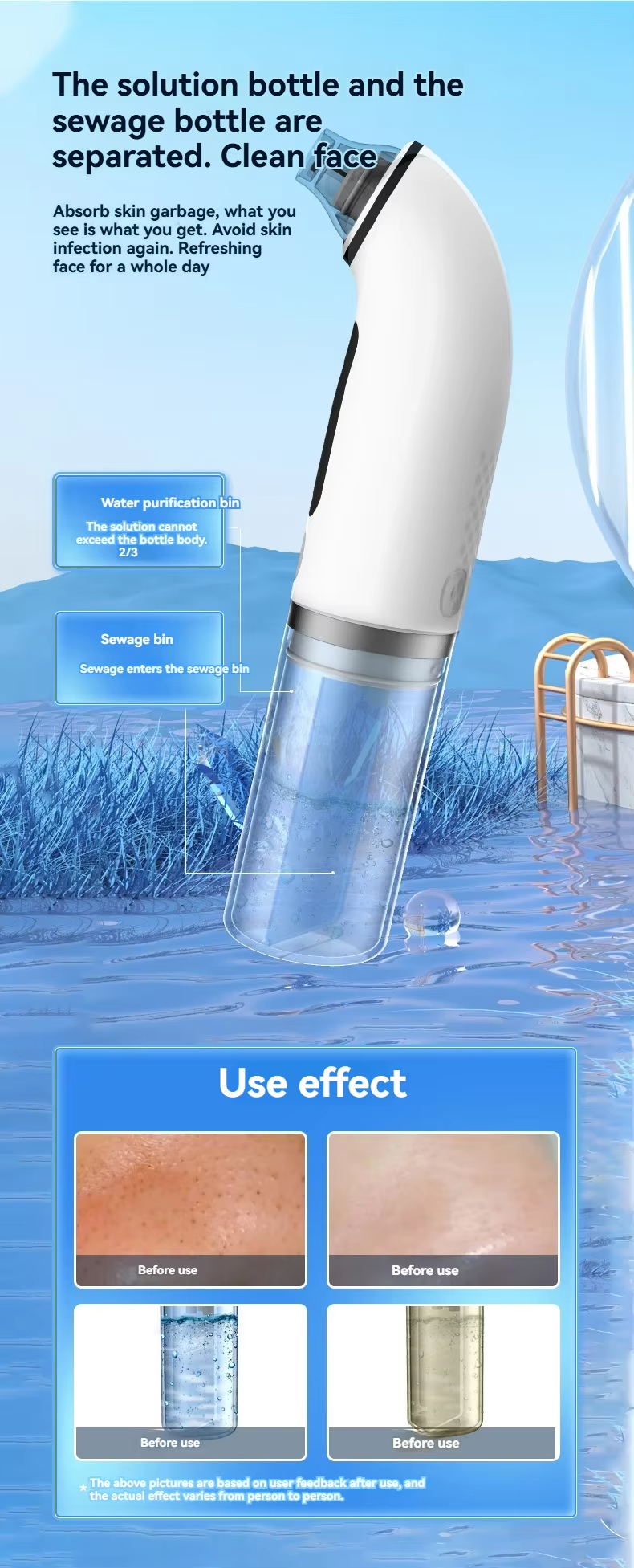 Temu ABS Vacuum Blackhead Remover Machine Facial Cleaning Nose Pore Suction Device