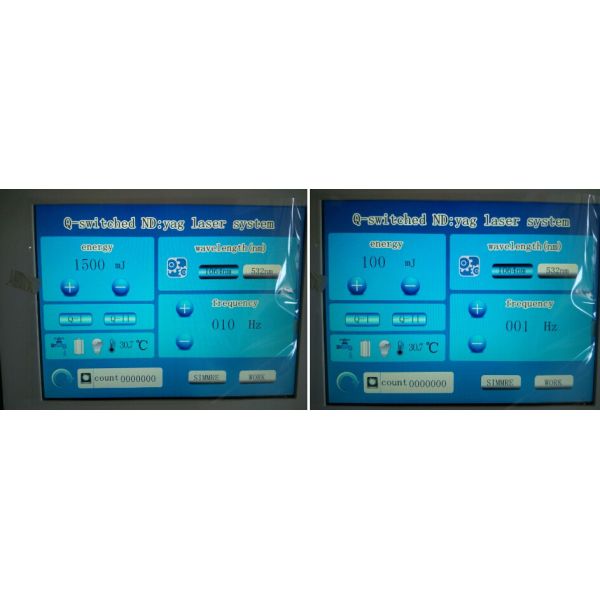 Sanhe SQ-3 laser tattoo removal q switched nd yaglaser / laser tattoo removal