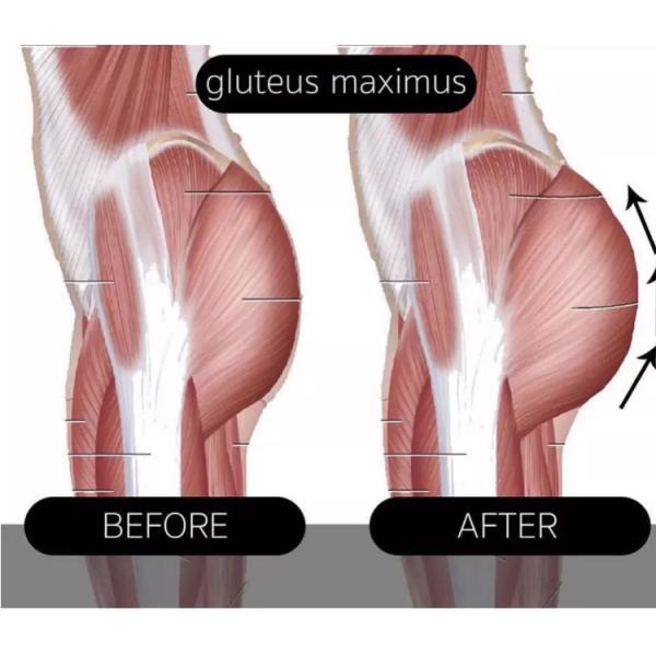 Ems Stimulate Body Sculpt Machine Muscle Buidling Neo Muscle Sculpt Machine