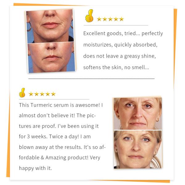 30ml Essence Face Serum 100% Pure Redness Radiant Skin Advanced Rosacea 1