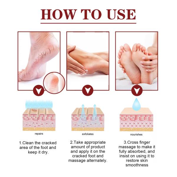 OEM ODM Hand And Foot Care Cream Anti Cracking Dry Peeling Repairing Cracks