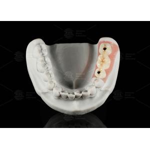 Buy cheap Screw Retained Titanium Custom Abutment Porcelain Fused To Zirconia from wholesalers