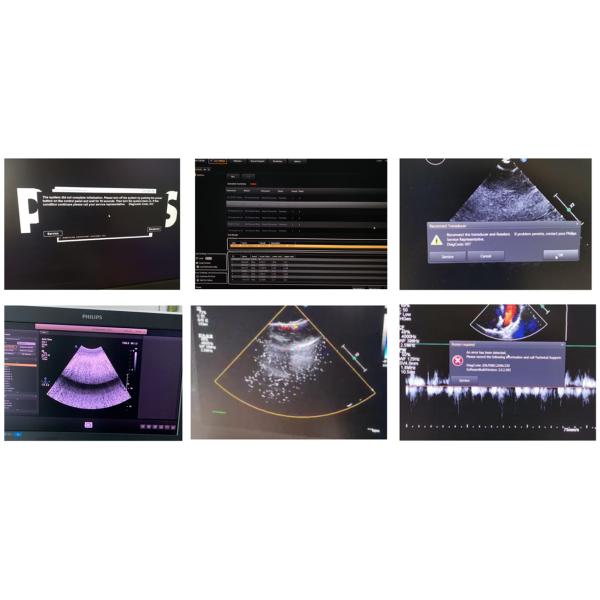 EPIQ ACQ Acquisition Module 453561734844 453561704246 Ultrasound Repair Service