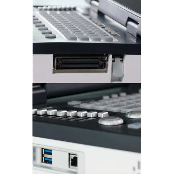 OB Portable Ultrasound Machine Durable 220V For Hospital Clinic