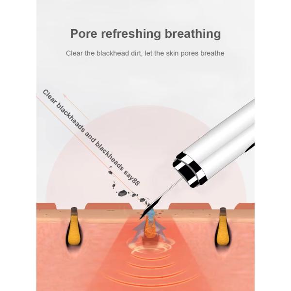 28kHz Frequency Ultrasonic Skin Scrubber Deep Cleaning Facial Pore Cleansing Exfoliator