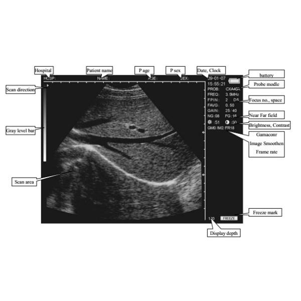 CLS5800 laptop Veterinary Ultrasound Scanner Full Digital Ultrasonic Diagnostic System