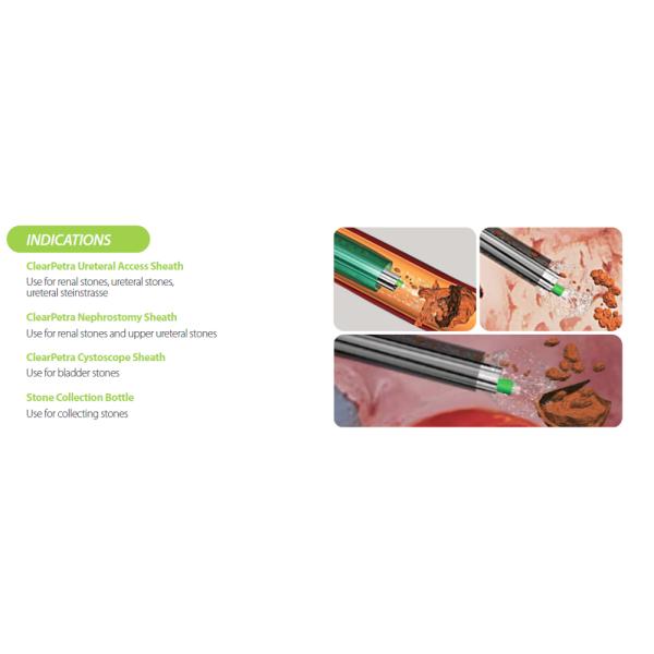 Silicon Ureteral Access Sheath , Clear Petra Ureteral Access Sheath