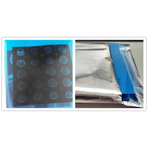 Digital Inkjet Printing Medical Imaging Film Blue X Ray For DR MRI CT