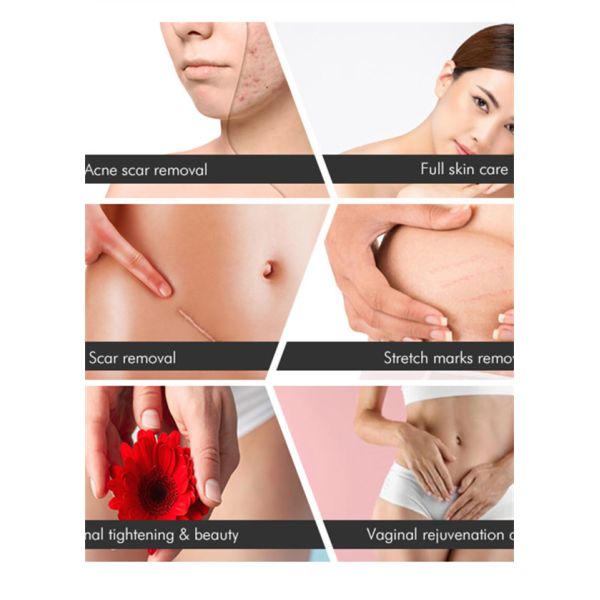 RF Acne Scar CO2 Fractional Laser Machine 10600nm For Fine Lines Removal