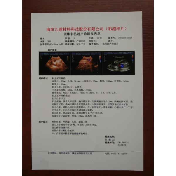 CE PET Based Inkjet Priting White A4 Medical Inkjet Dry Film