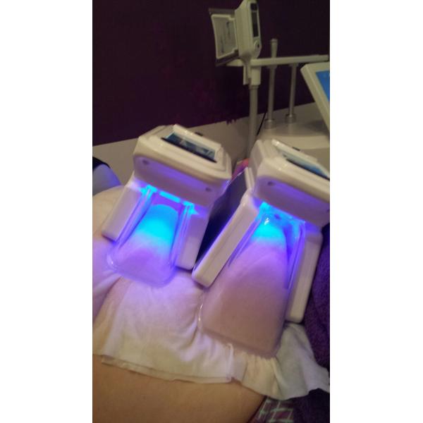 4-5cm fat lost after 1 treatment wind+water+semiconductor cooling system cryotherapy slimming machine