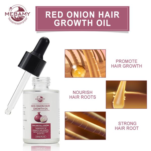 Wholesale Red Onion Hair Growth Oil Argan Oil Herbal Anti Hair Growth Serum Fight Against Hair loss