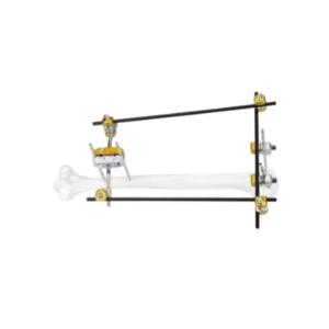 Quality Proximal Humerus Medical External Fixator wholesale