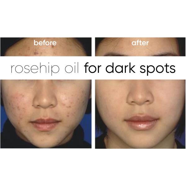 30ml Organic Pure Rosehip Oil , Jojoba Essential Oil For Anti Scar / Anti Aging