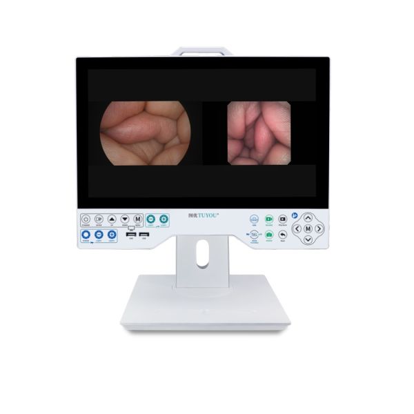 15 Inch FHD Camera System Compatible Flexible And Rigid Endoscope Professional Manufacturer