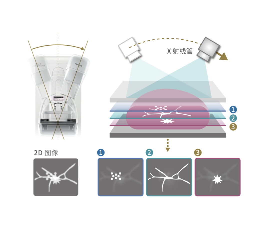 Fujifilm ASPIRE Cristalle FDR MS-3500 Digital Mammography System with High-Resolution Images
