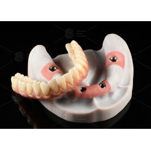 Buy cheap Composite Pink Porcelain Crown A1 Shade All On 4 Hybrid Titanium Screw Retained from wholesalers