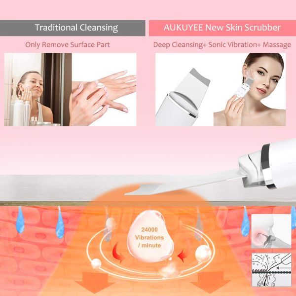 Skin Care Electric Face Cleaning Scrubber Exfoliator Pore Removal Sonic Facial Spatula