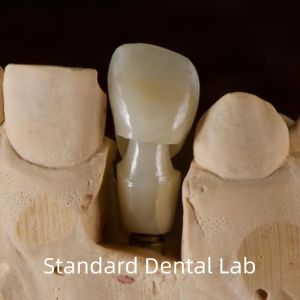 China Dental Implant Tibase Zirconia Abutment Titanium Accuracy Customized on sale