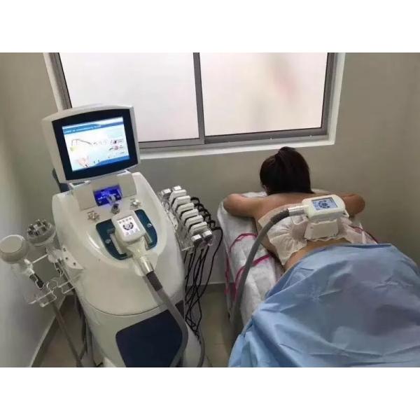 Fat Freezing 6Hz Vela Slimming Machine