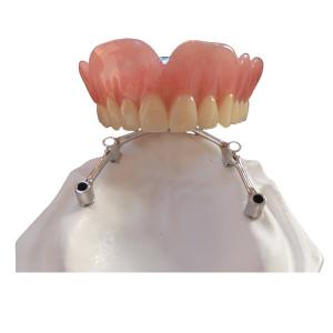 China COCR Tooth Implant Crown FDA Dental Implants With Titanium Bar on sale