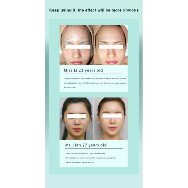 7 Handles Hydrodermabrasion And Oxygen Machine 250W Hydrotherapy Facial Machine 90Kpa