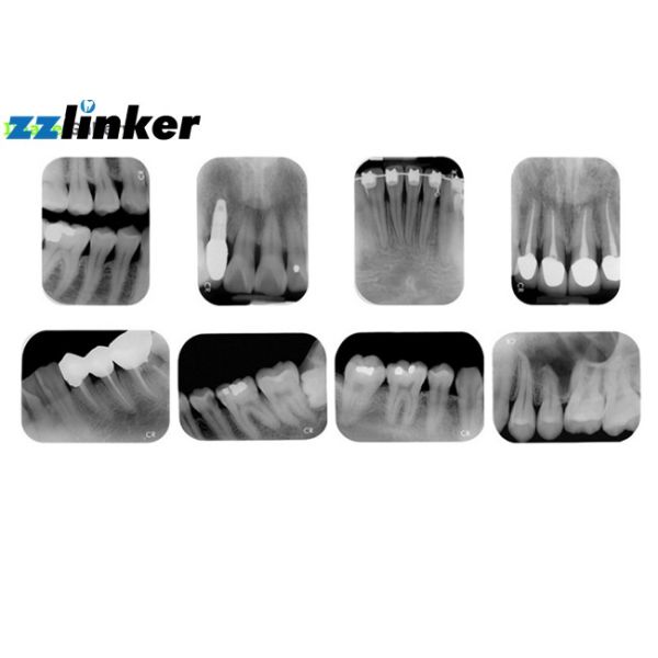 Mobile Dental X Ray Machine , Apixia PSP Dental X Ray Film Scanner Teeth Imaging