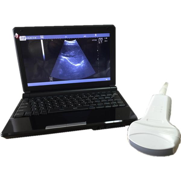 B ZOOM Portable Color Doppler Ultrasound Scanner Machine USB Port