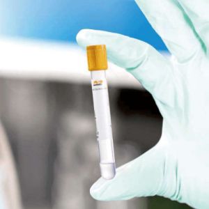 China Free Sample Sterile Vacuum Blood Collection Tube on sale