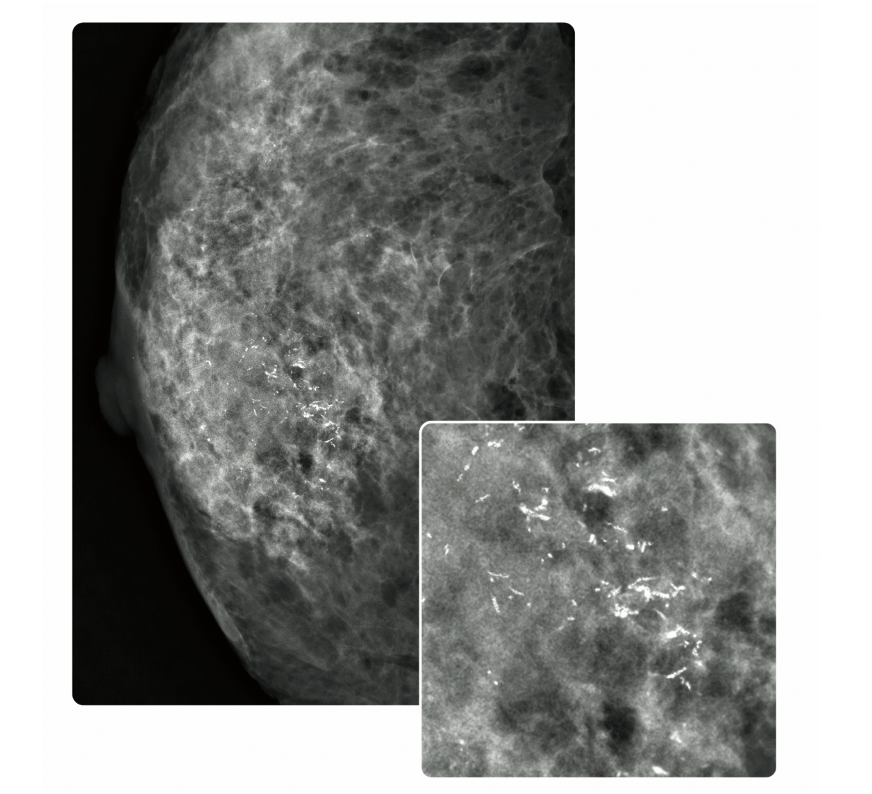 Fujifilm ASPIRE Cristalle FDR MS-3500 Digital Mammography System with High-Resolution Images