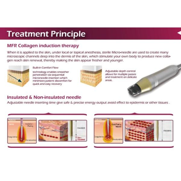 2018 hot sale 5M Hz machine radio frequency facial rejuvenation acne removal price