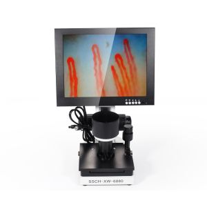 Quality LCD Digital Biological Microscope Microcirculation Checking Capillary Microscope wholesale