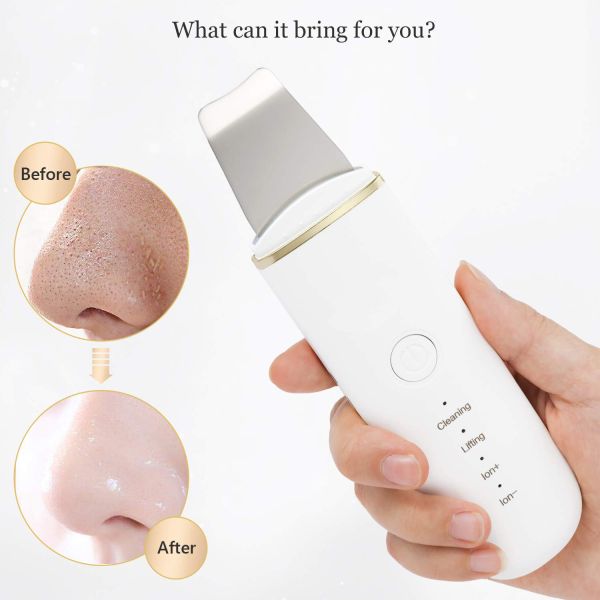 Skin Care Electric Face Cleaning Scrubber Exfoliator Pore Removal Sonic Facial Spatula