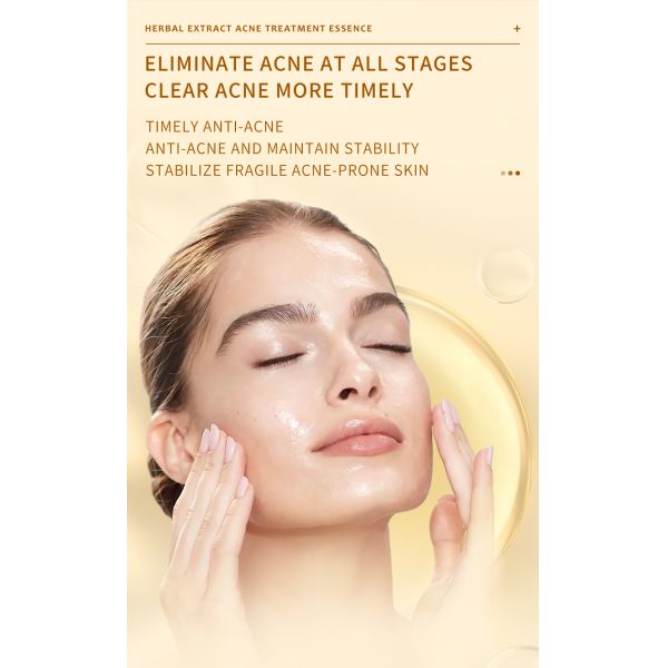 Skincare Essence Face Serum Moisturizer Cream For Anti Acne Facial Whitening 50g