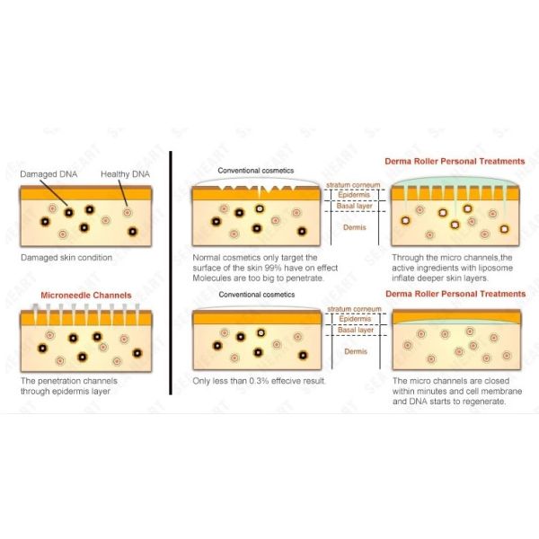 dermaroller99