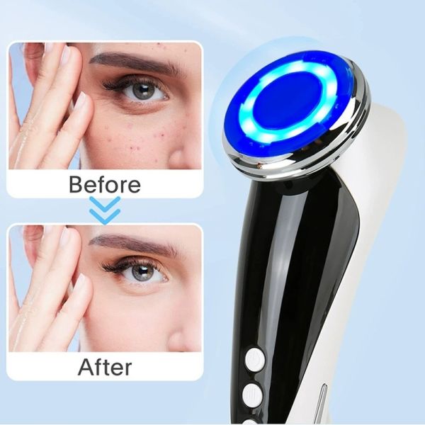 Handheld Multifunction Beauty Device Skin Firming Hot And Cold Photon Beauty Machine