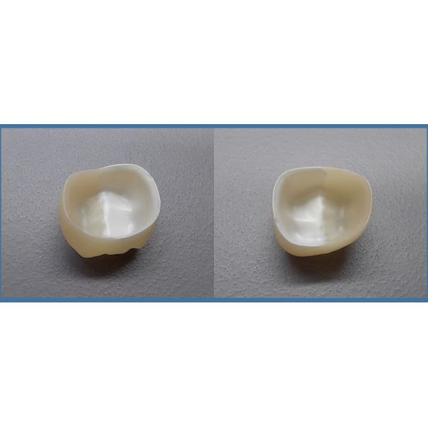 No Separate Glazing Dental Paste 12-38°C Storage Stability Manual Power Source Shelf Life 1years Steam/Ultrasonic Compatible