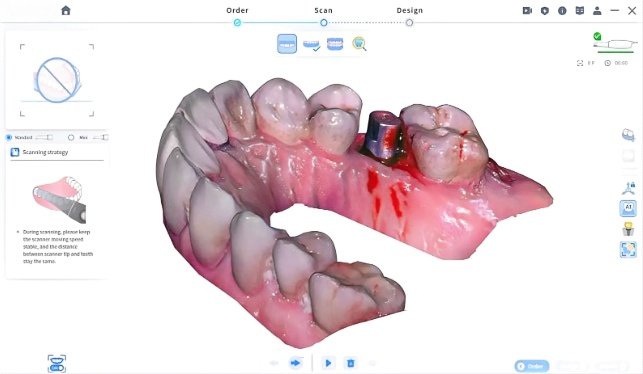 Versatile LMAI-30 3D Scanne 25mm Depth for Implants Ortho & Prosthodontic Solutions